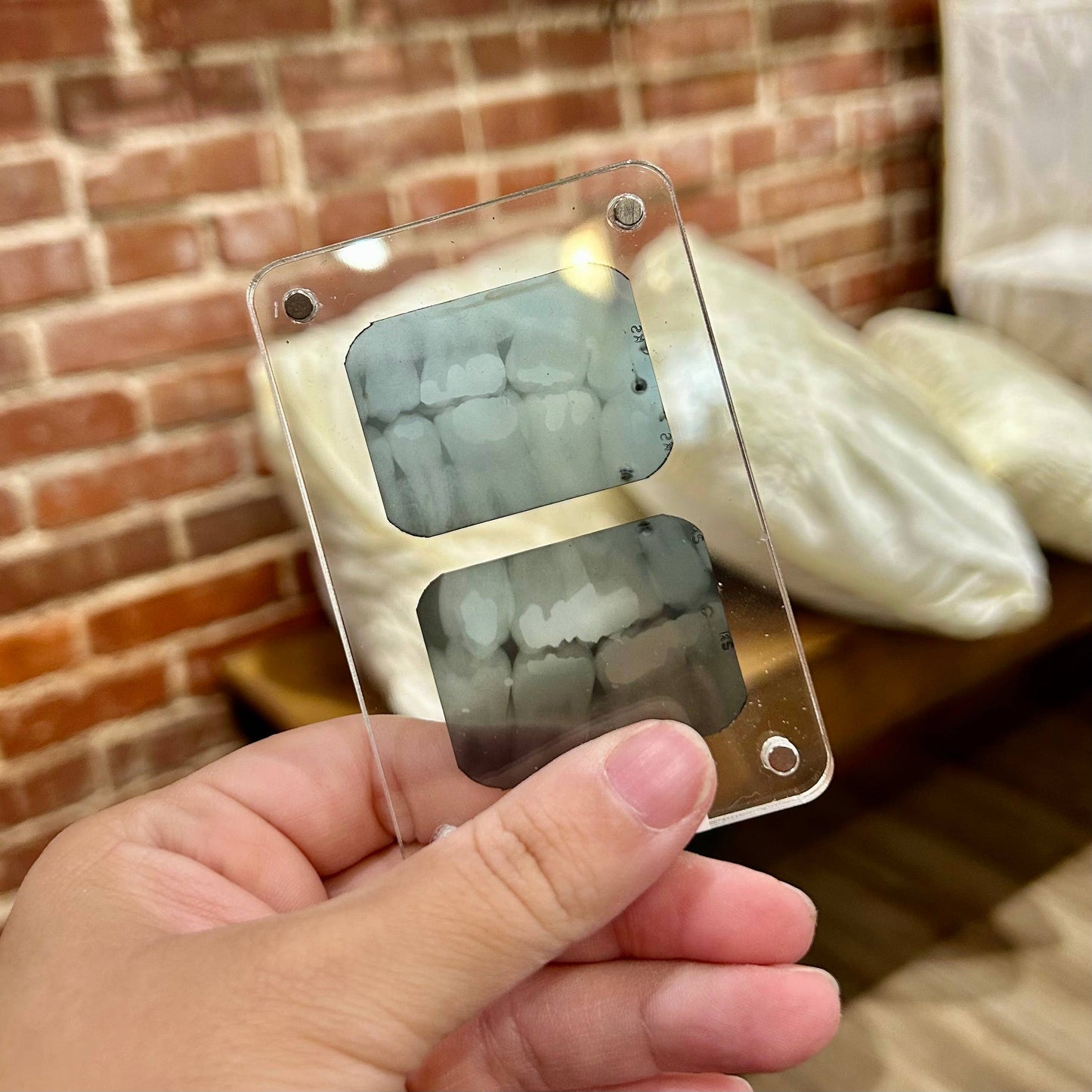 Dental X-Ray Magnet