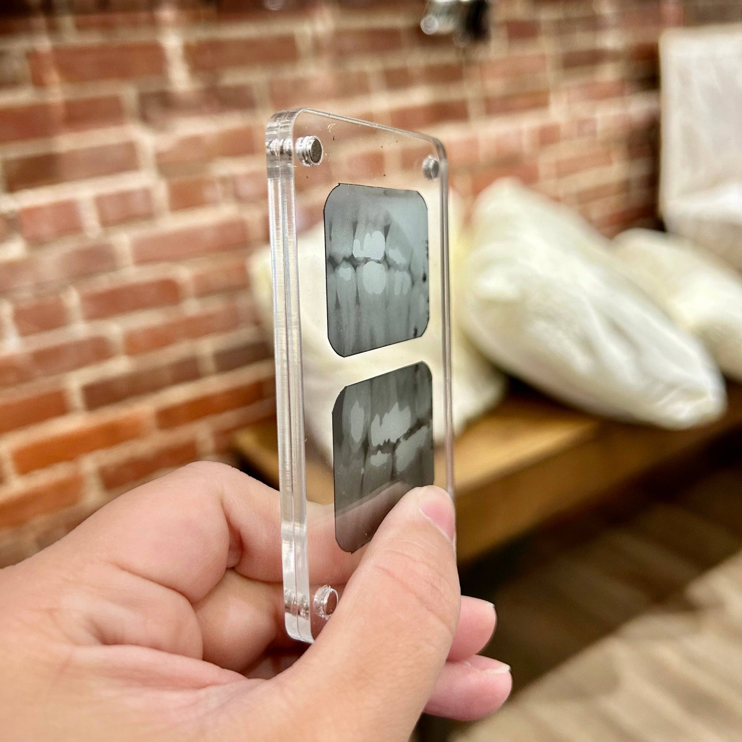 Dental X-Ray Magnet